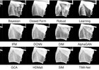 Deep Image Matting: A Comprehensive Survey